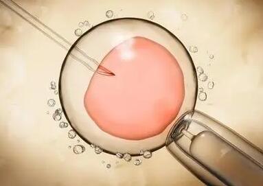输卵管粘连做手术还是试管婴儿，绝经期可以做试管婴儿吗